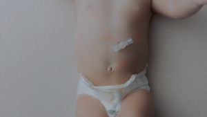 Gastrostomy