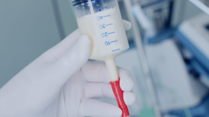 Nasogastric Tube (NGT)