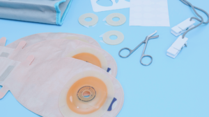 Colostomy